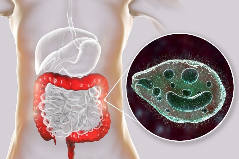 Balantidium coli - az emberi emésztőrendszer vastagbelét fertőző parazita.