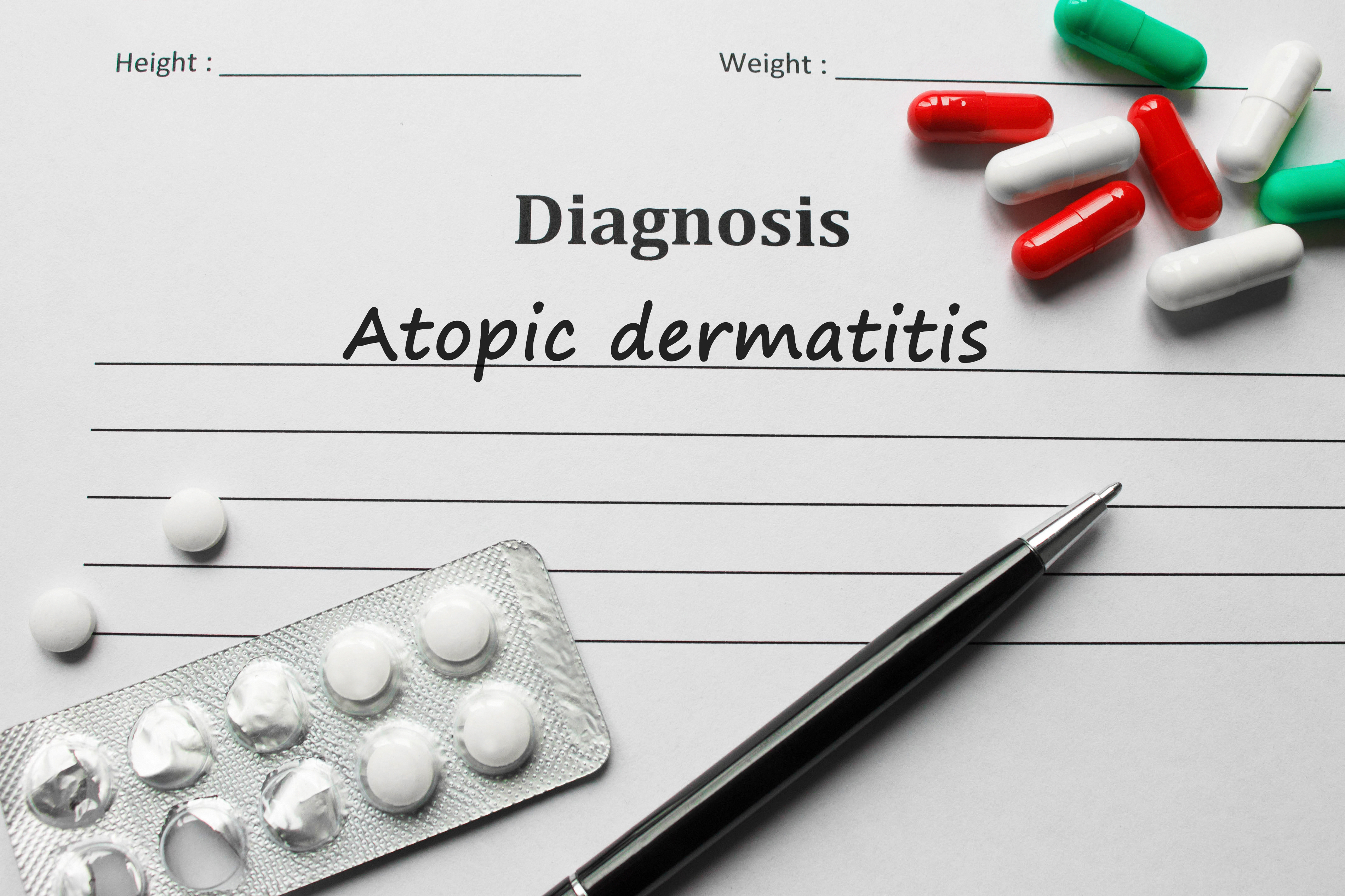 Az atópiás dermatitis diagnózisa