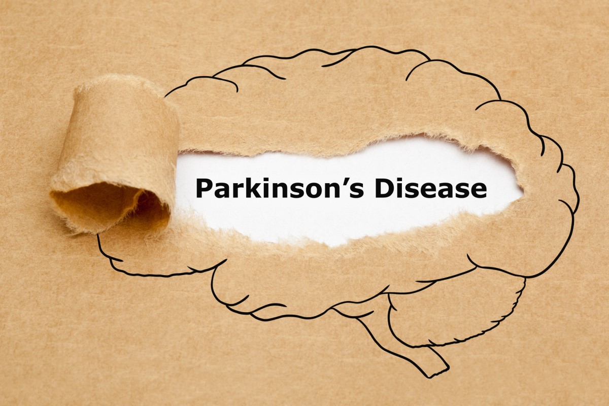 Morbus parkinson = Parkinson-kór = Parkinson-kór - animáció egy Parkinson-kóros agyról a közepén