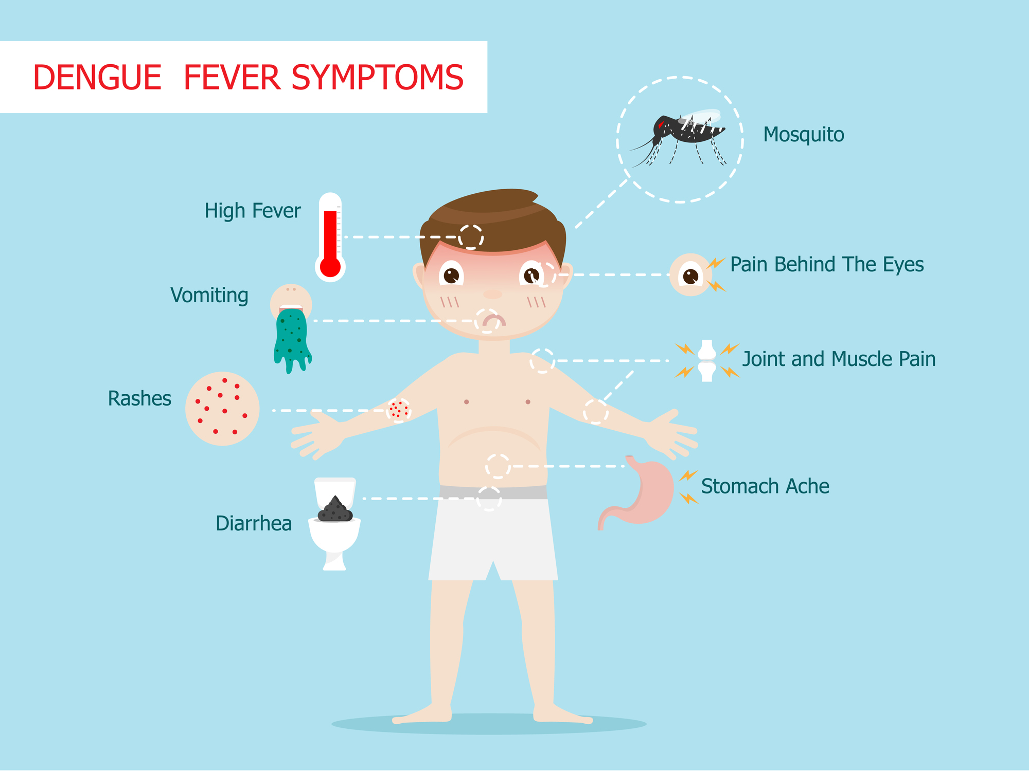 A dengue-láz tünetei