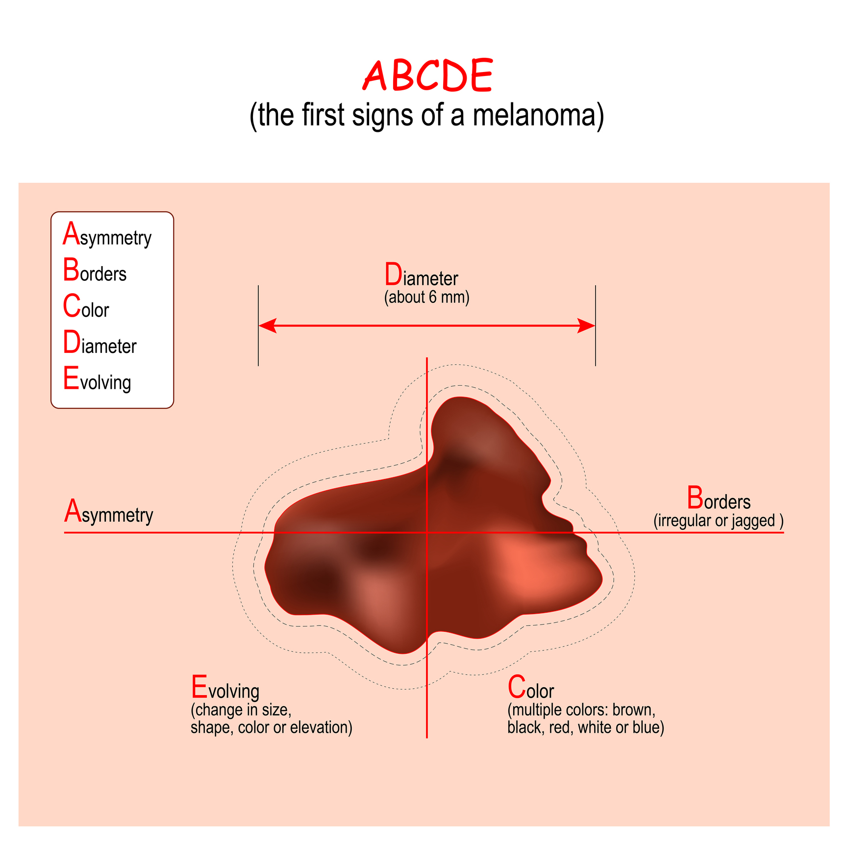 ABCDE algoritmus