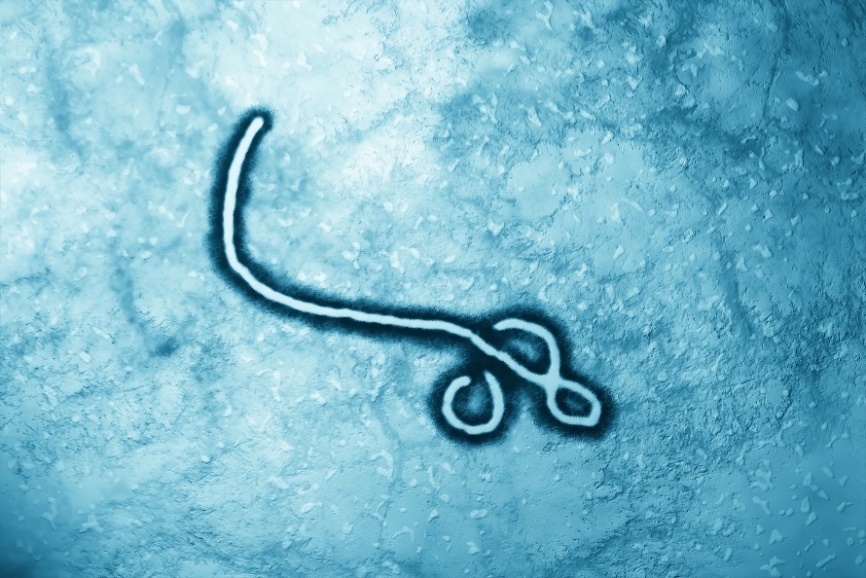 Ebola vírus mikroszkóp alatt