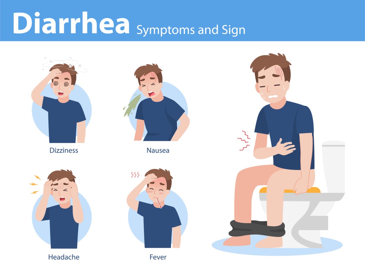 Hasmenés (diarrhoea) és a lehetséges kísérő tünetek: szédülés (hányinger, szédülés), hányinger (hányás), fejfájás, láz (emelkedett testhőmérséklet), görcsök és hasi fájdalom.