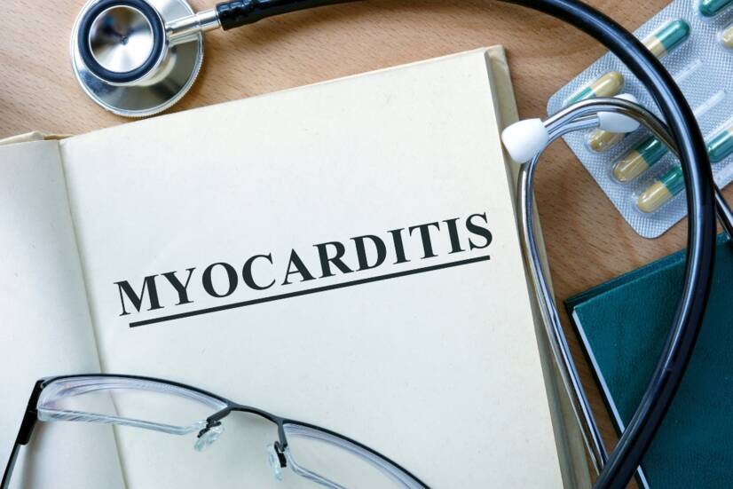 Myocarditis: a szívizom gyulladása. Myocardialis infarctus, a szívbetegség egy fajtája.