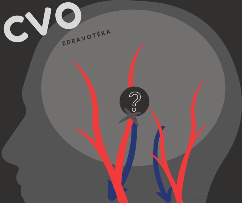 Cerebrovaszkuláris betegség: meggyengült, beszűkült vagy kitágult agyi erek? Ismerje az okokat és a tüneteket!