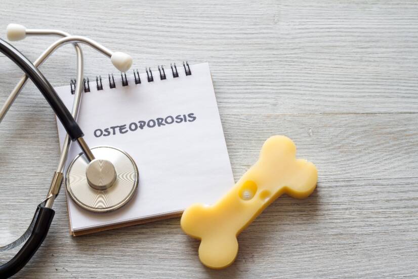 OSTEOPOROSIS: Amikor a csontok meggyengülnek és a kezelés nehézkes. Mik az okok, tünetek és következmények + tippek a megelőzéshez?