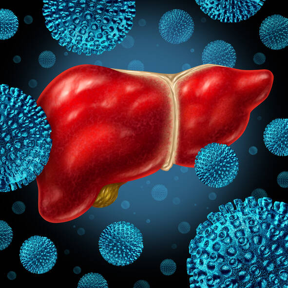 Mi a fertőző májgyulladás és hogyan terjed (Hepatitis A/B/C/D)?