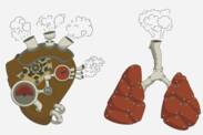 Pulmonális hipertónia: mi ez és miért alakul ki? + Tünetek és kezelés